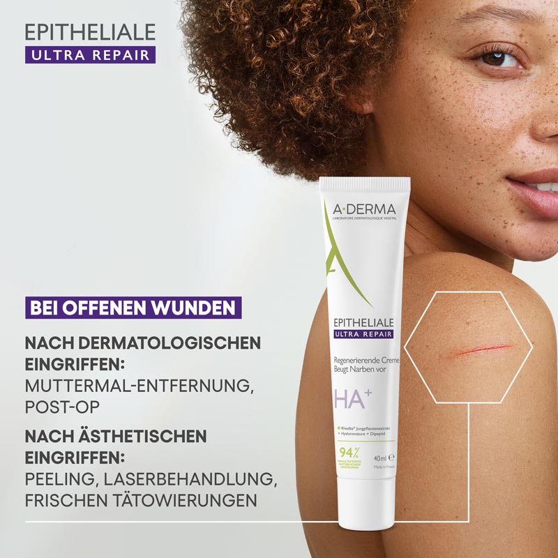 A-DERMA EPITHELIALE ULTRA REPAIR Regenerierende Creme 40 ml Creme