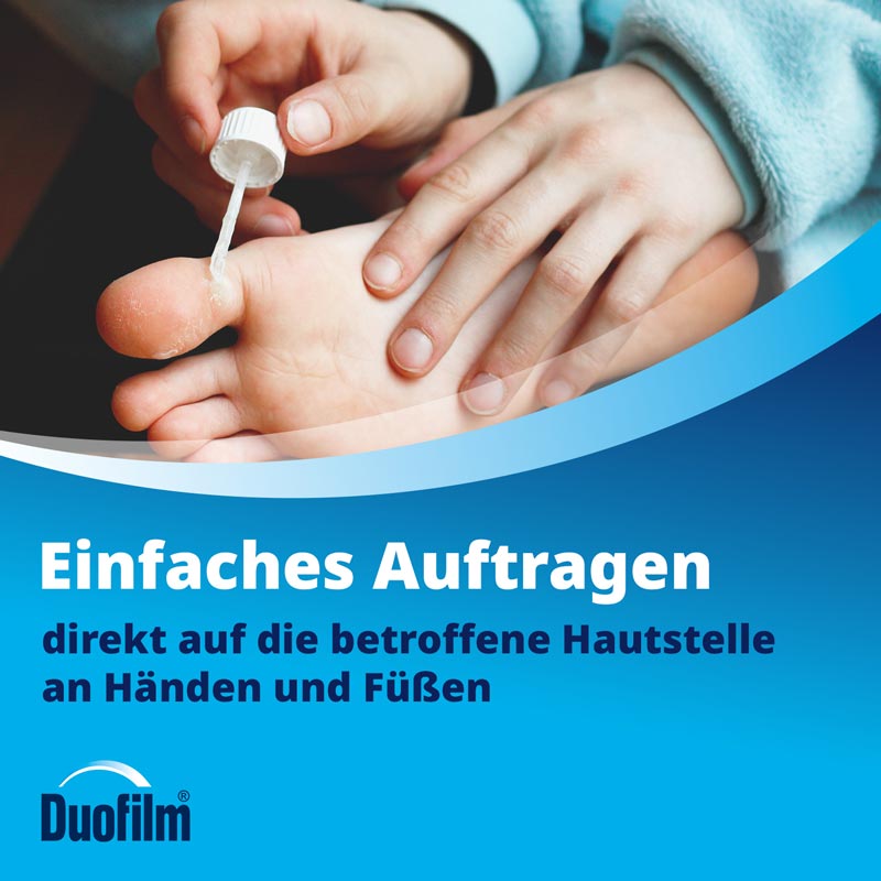 Duofilm 15 ml Lösung