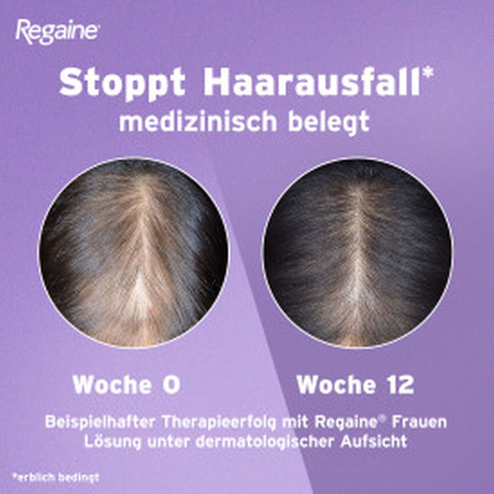 REGAINE Frauen Lösung (1 Monats Packung) bei erblich bedingtem Haarausfall