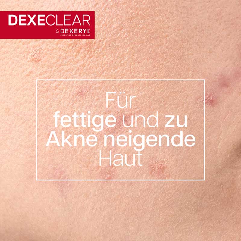 DEXECLEAR schäumendes Reinigungsgel bei unreiner Haut 400 ml Gel