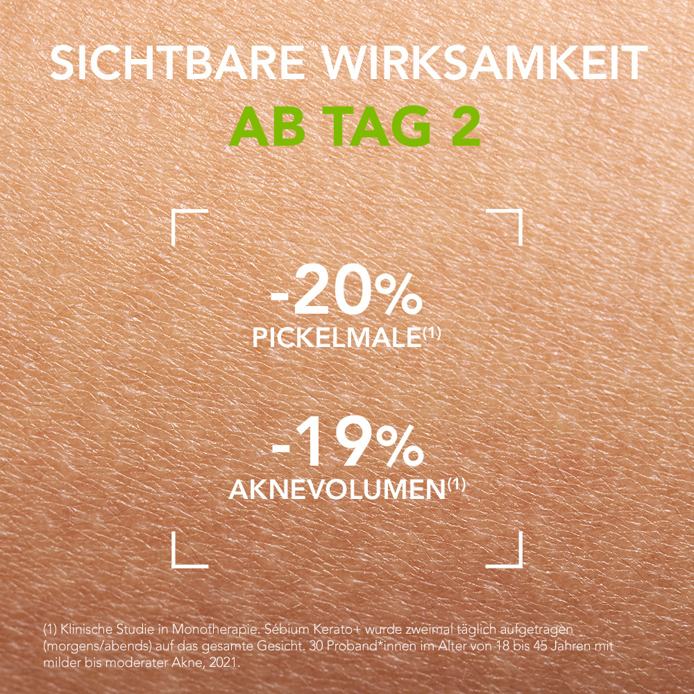 BIODERMA Sebium Kerato+   30 ml Tube