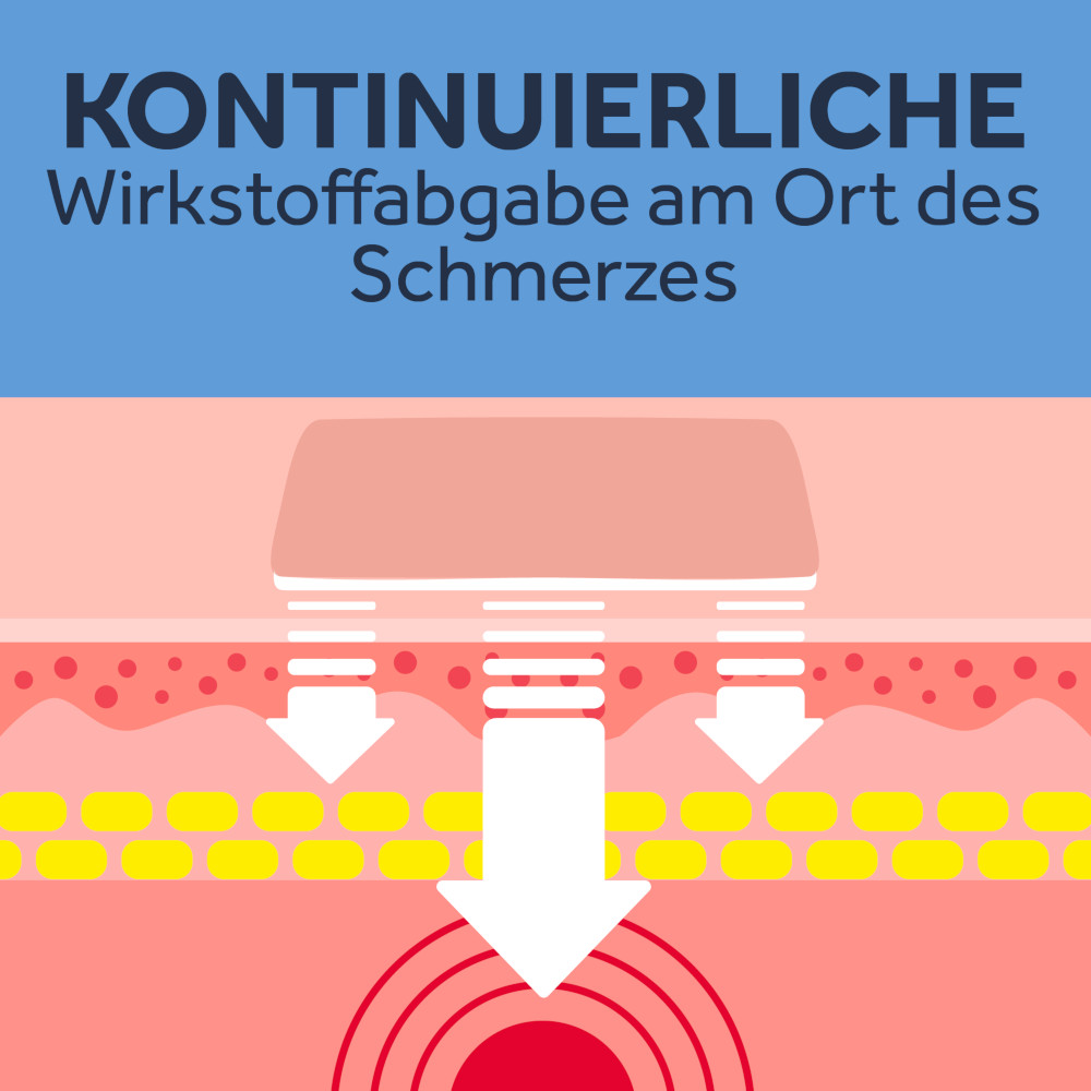 NUROFEN 24-STUNDEN SCHMERZPFLASTER 4 St Pflaster