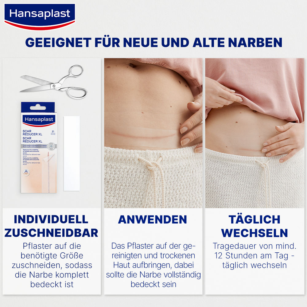 Hansaplast Narben Reduktion XL, 21 Pflaster 21 St Pflaster