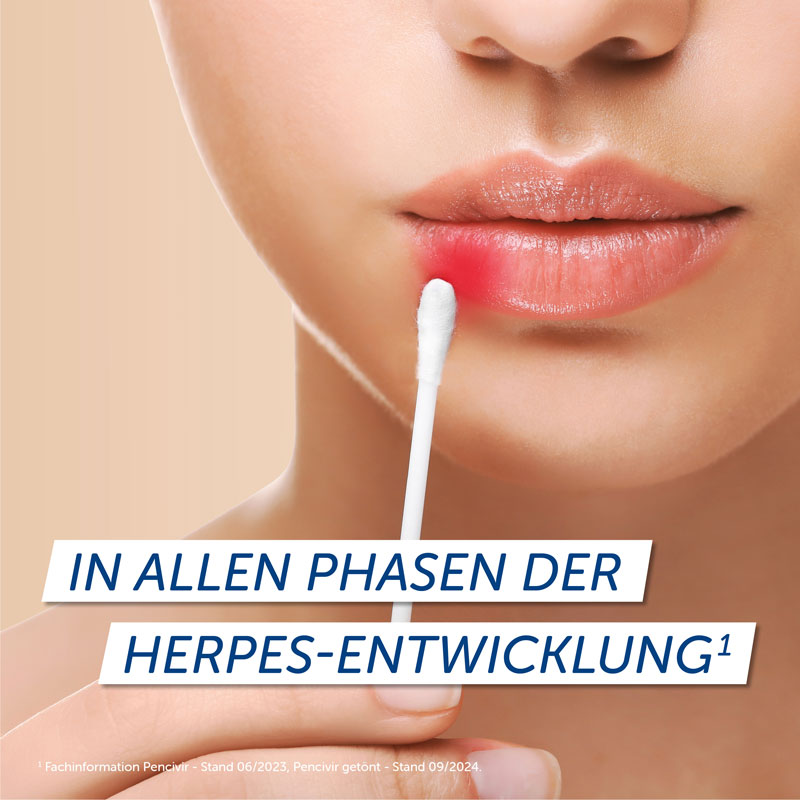 PENCIVIR BEI LIPPENHERPES 2 g Creme