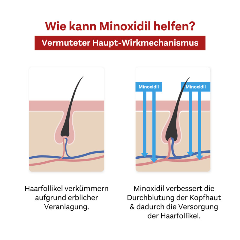 Doppelherz Pharma Minoxidil SCHAUM FÜR MÄNNER 3X60 g Schaum