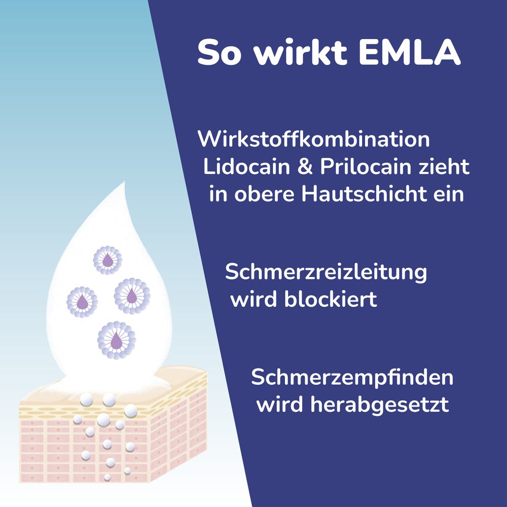 Emla 25 Mg/g + 25 Mg/g Creme + 12 Tegaderm  5X5 g Creme