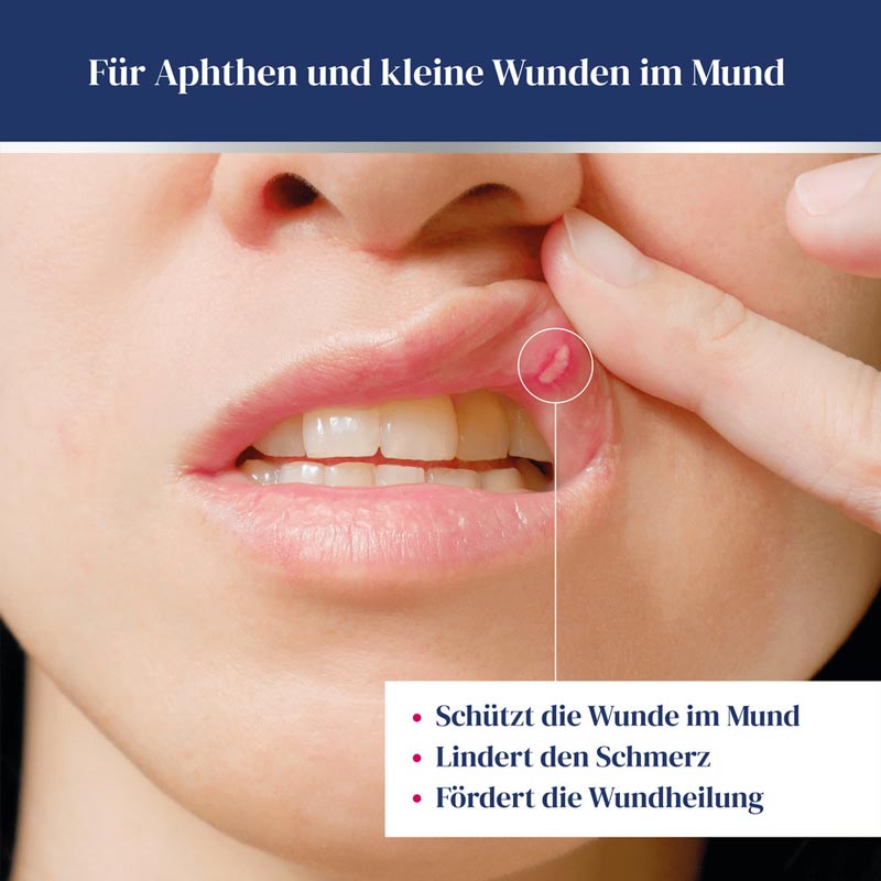 URGO GEL AFTEN APHTHEN GEL Junior 8 ml Gel
