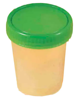 URINBECHER mit Schraubdeckel 1 St