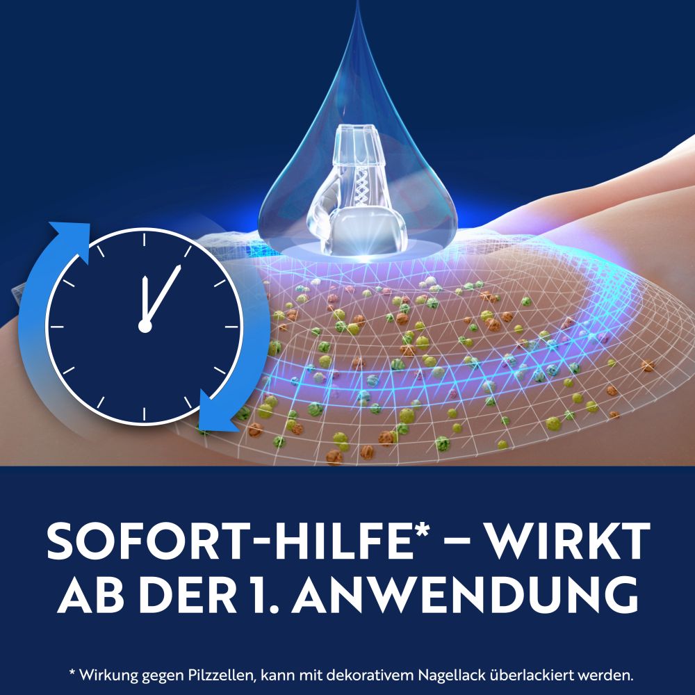 Loceryl Nagellack GEGEN NAGELPILZ 1.25 ml Wirkstoffhaltiger Nagellack