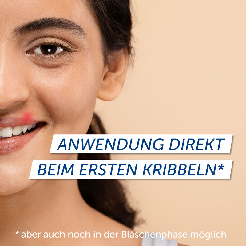 PENCIVIR BEI LIPPENHERPES 2 g Creme