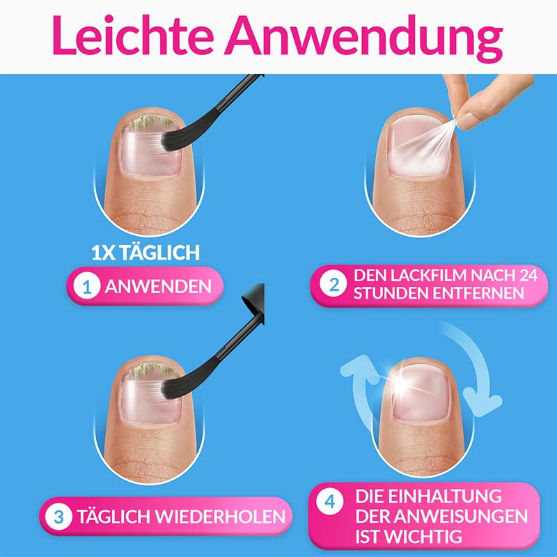 excilor INTENSIV LACK GEGEN NAGELPILZ 30 ml Lösung