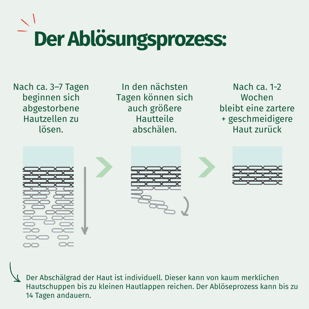 Allgäuer Latschen Kiefer Hornhaut Entferner Maske 1 Packung