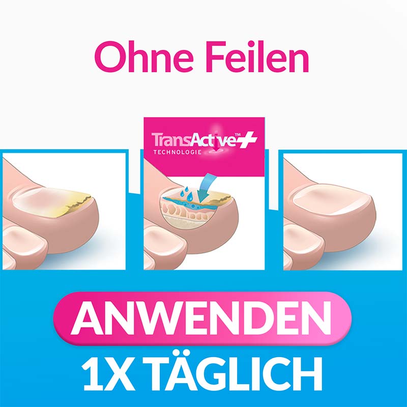 excilor INTENSIV LACK GEGEN NAGELPILZ 30 ml Lösung
