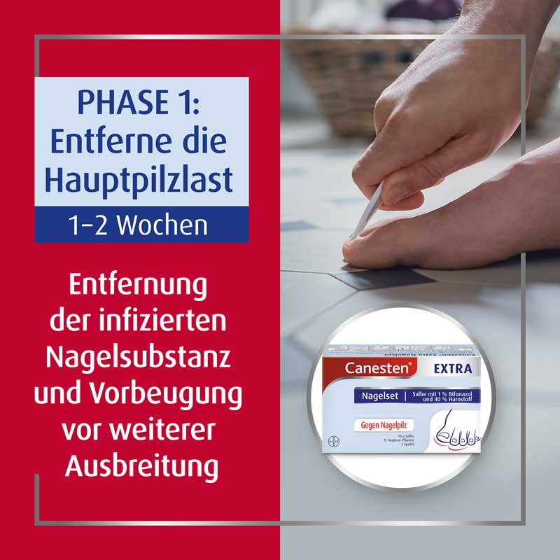 Canesten EXTRA Nagelset 1 St Salbe