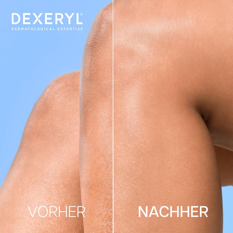 DEXERYL Shower Duschcreme 500 ml Duschgel