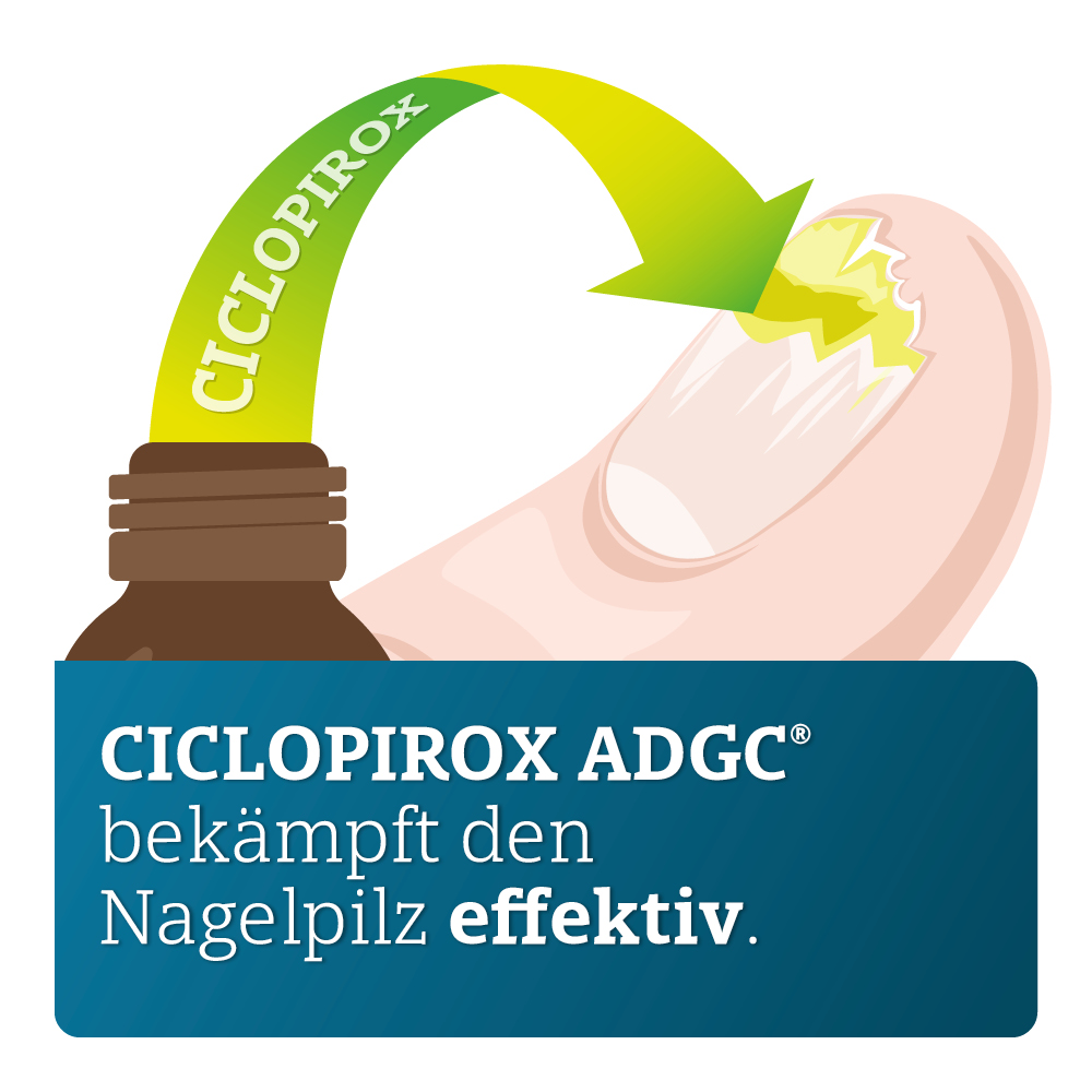 CICLOPIROX ADGC 80 mg/g Nagellack 3.3 ml Wirkstoffhaltiger Nagellack