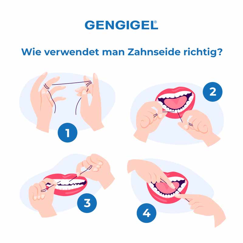 GENGIGEL ORAL SPRAY 20 ml Spray