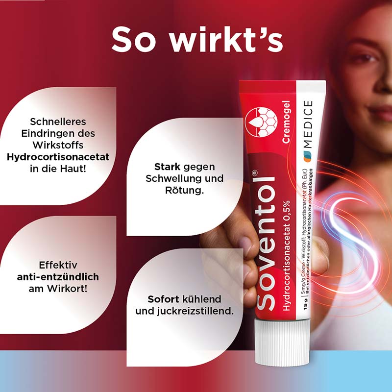 Soventol HydroCortisonACETAT 0,5% bei Hautentzündungen 15 g Creme