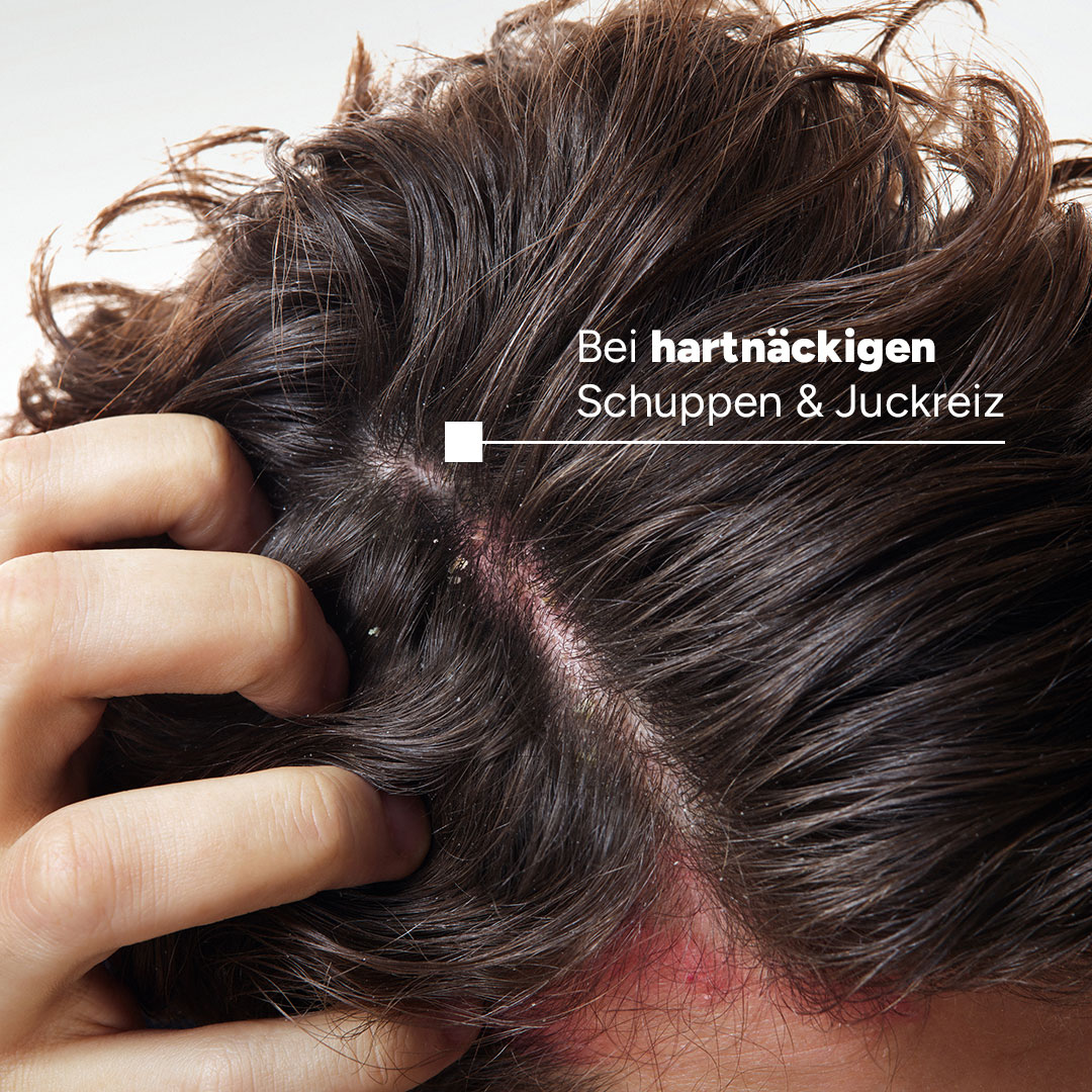 DUCRAY KELUAL DS Anti-Schuppen-Shampoo 100 ml Shampoo