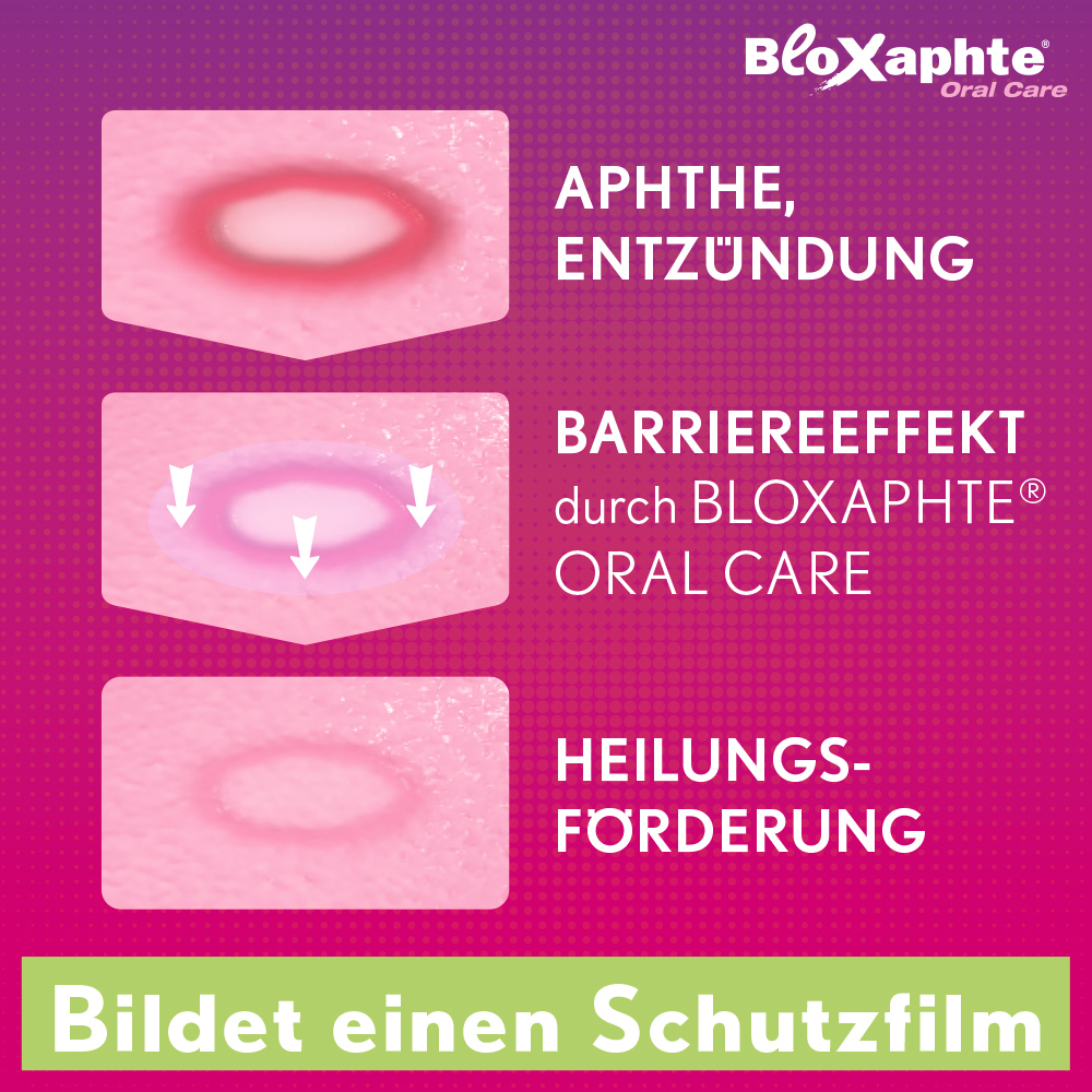 Bloxaphte Oral Care Junior-Gel bei Verletzungen im Mund 15 ml Gel