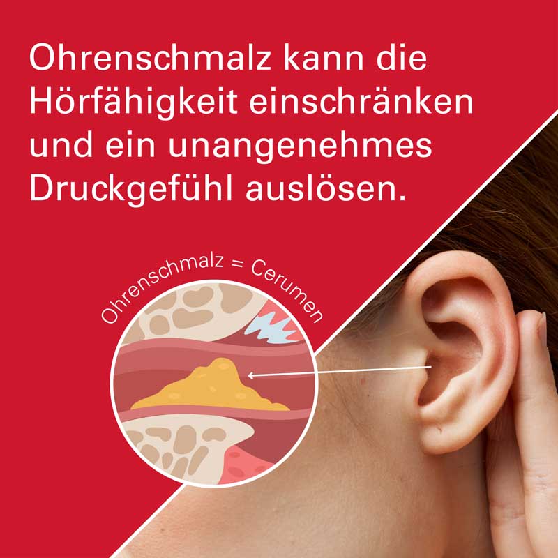 OTITEX Ohrentropfen 10 ml Ohrentropfen