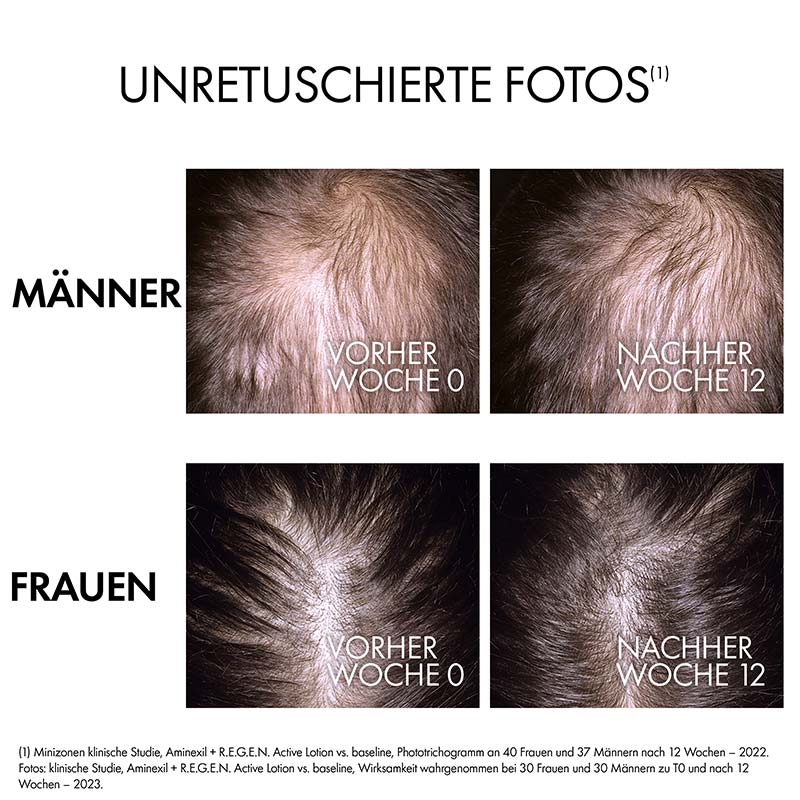 VICHY DERCOS R.E.G.E.N. BOOSTER 90 ml Flüssigkeit