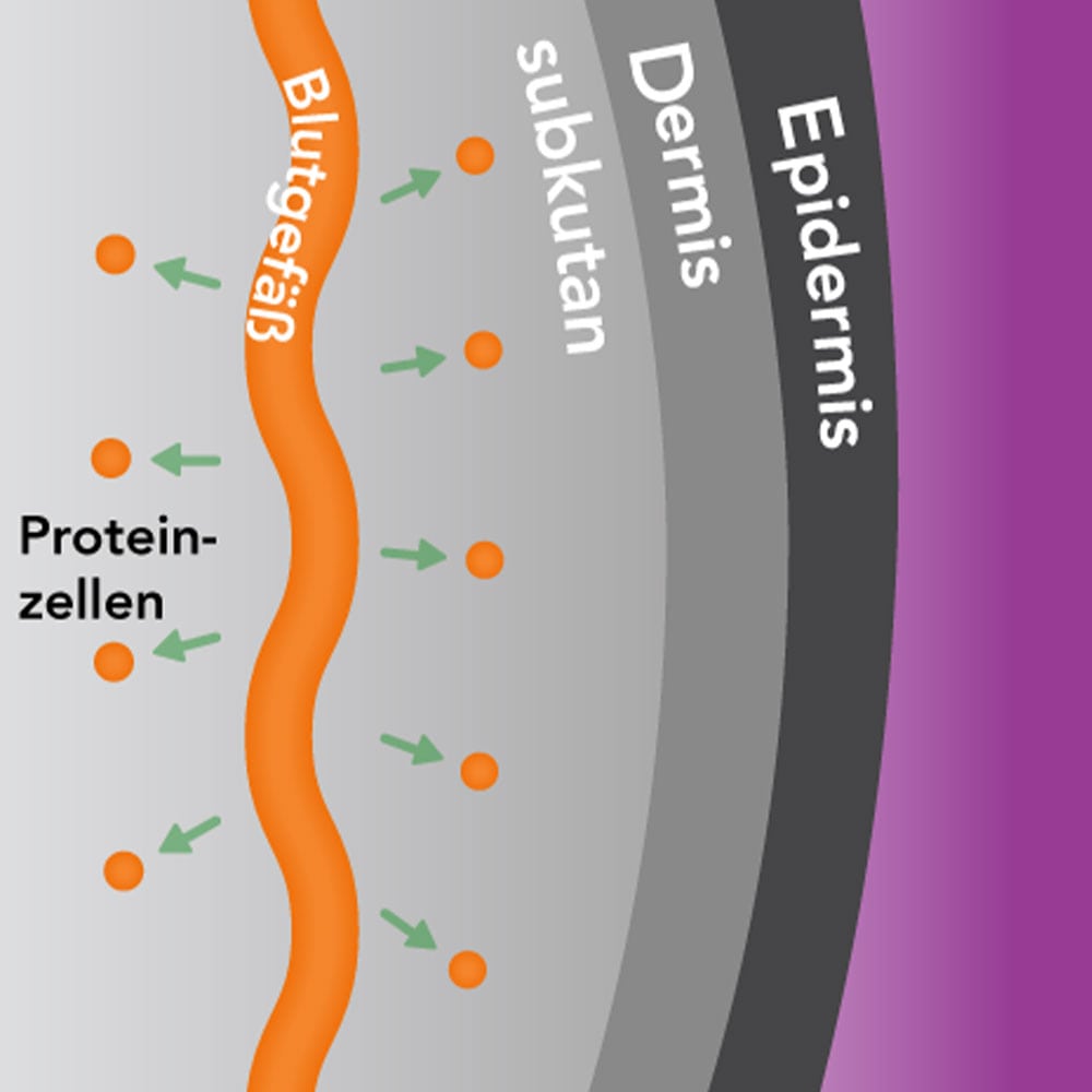 REVITIVE ULTRASCHALL-THERAPIE 1 St