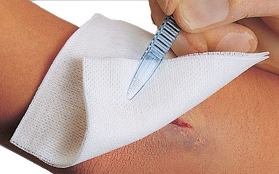 Vliwasoft Vliesstoffkompressen 7,5x7,5cm unsteril 4 lagig 100 St Kompressen