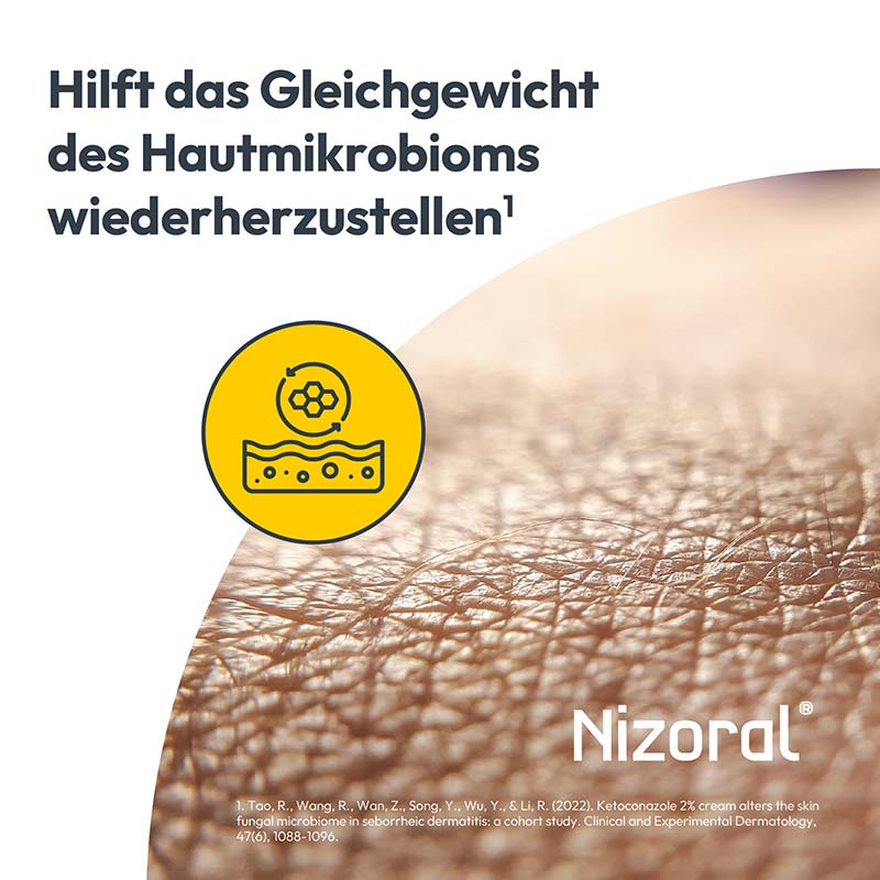 Nizoral 2% Hautpilz Creme – Effektive Hilfe bei Haut- & Fußpilz 30 g Creme