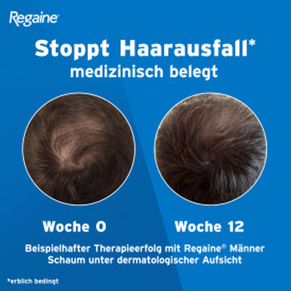 Regaine MÄNNER Schaum (3 Monats Packung) bei erblich bedingtem Haarausfall
