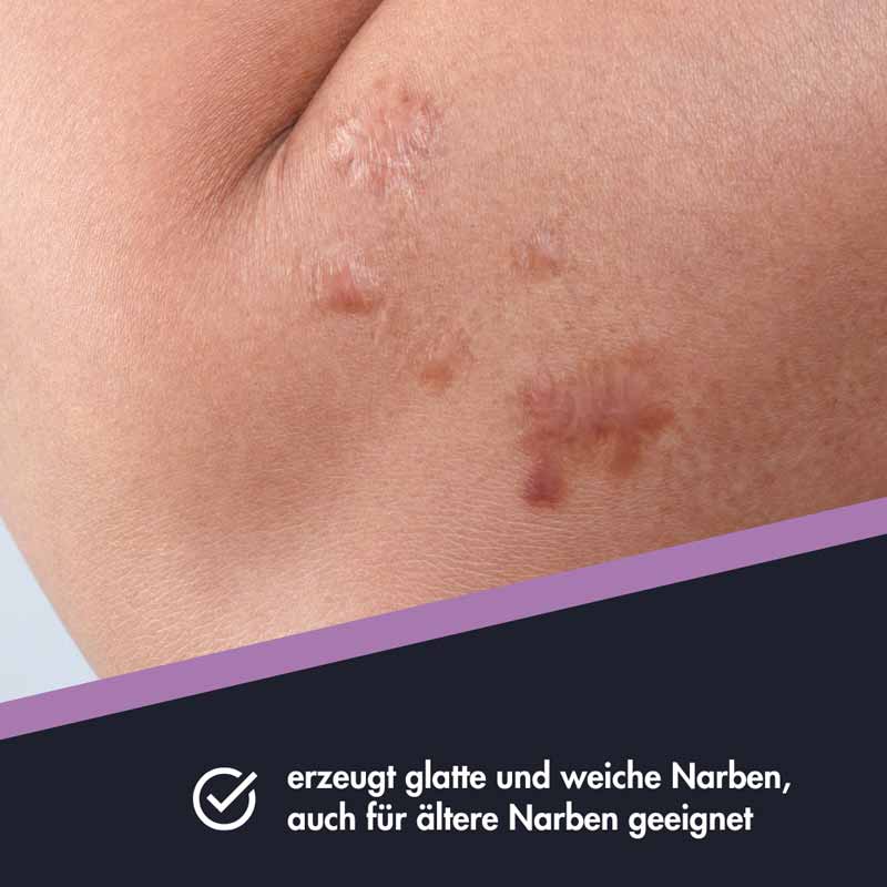 ENSBONA Narbenpflege 20 ml Salbe