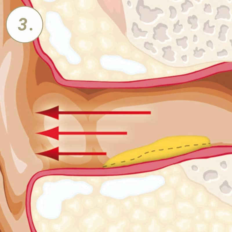VAXOL OHRENSPRAY 10 ml Spray