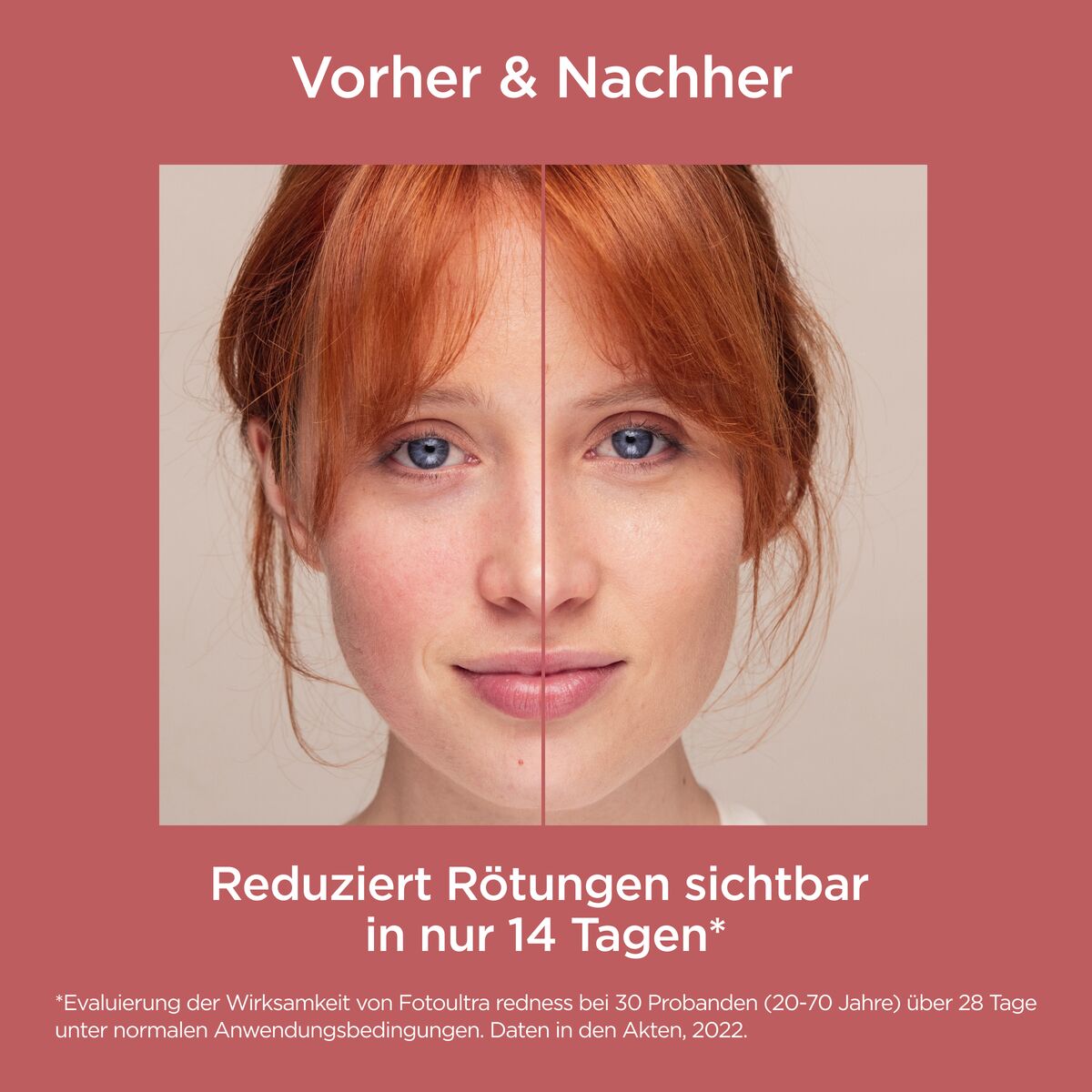 ISDIN FOTOULTRA Redness LSF 50 50 ml Creme