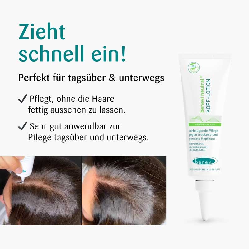 BENEVI Neutral Kopf-Lotion 50 ml Lotion