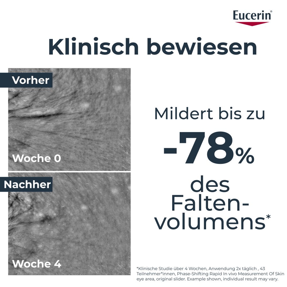 Eucerin HYALURON-FILLER EPIGENETIC SERUM 30 ml Konzentrat