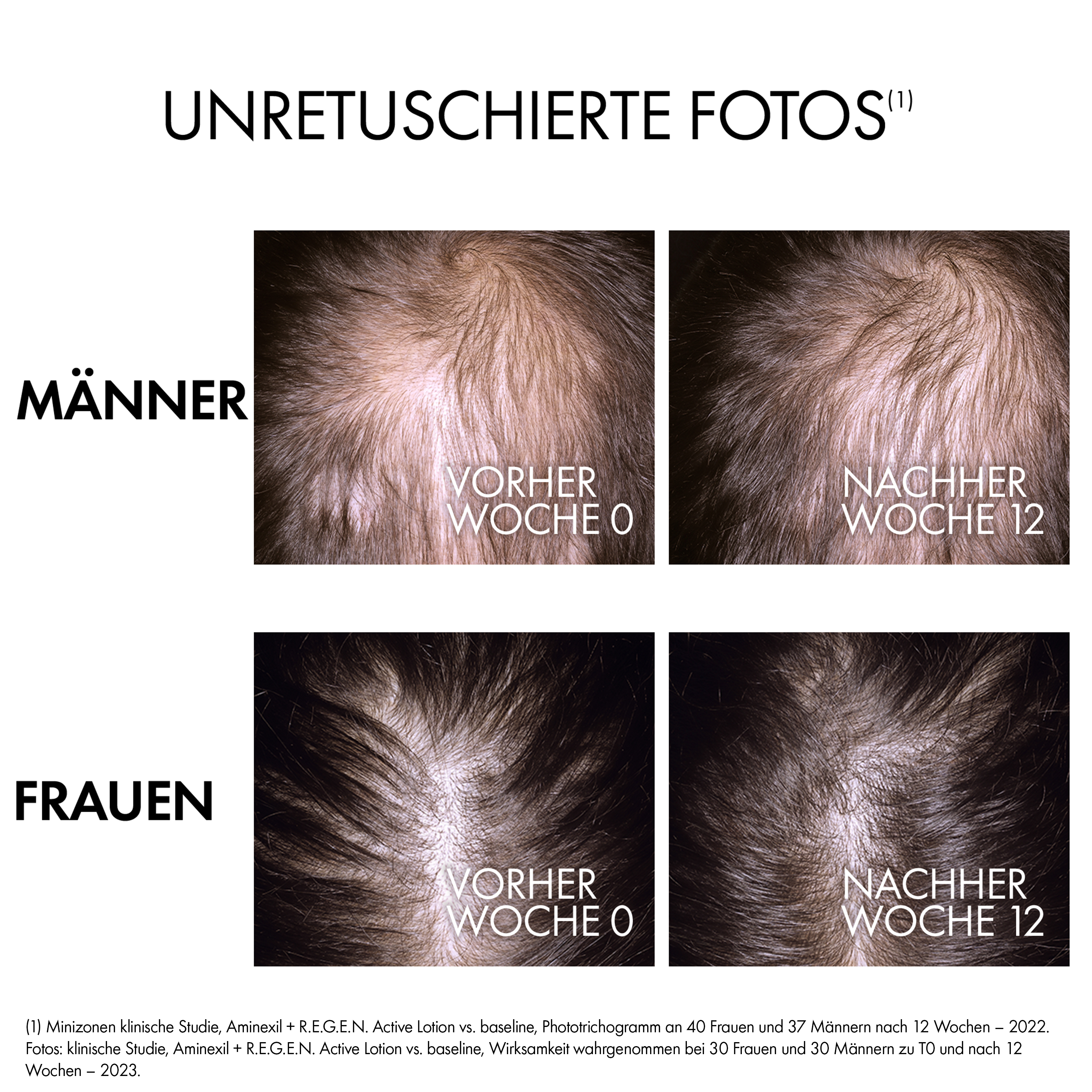 VICHY DERCOS R.E.G.E.N. BOOSTER 90 ml Flüssigkeit