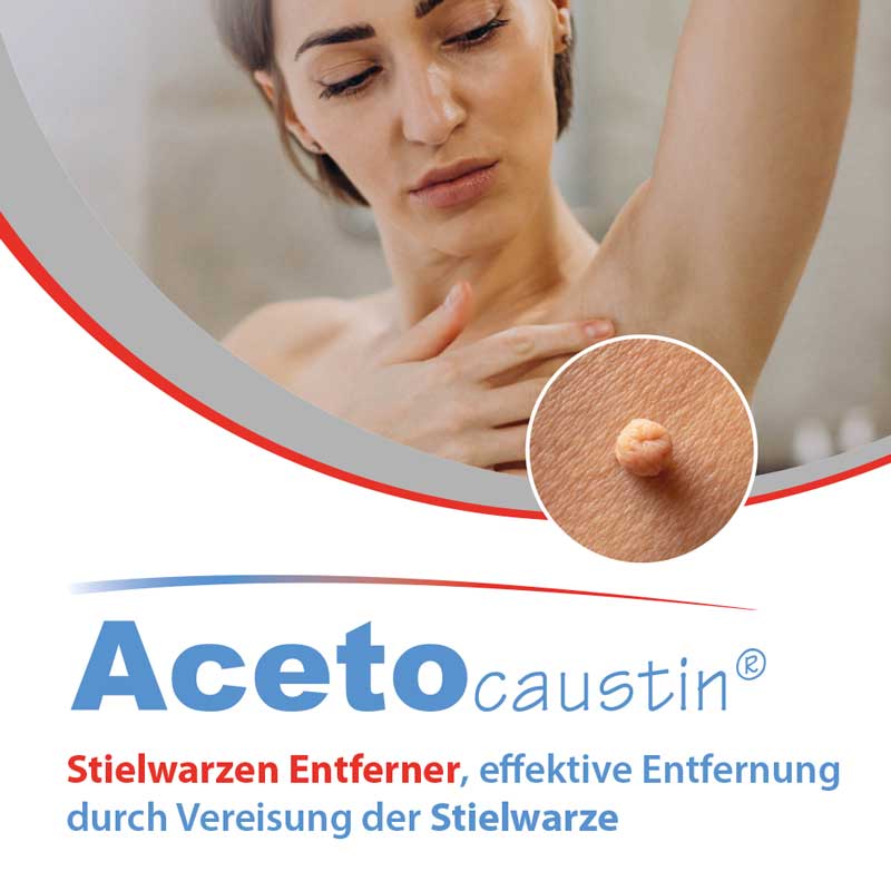 Acetocaustin Stielwarzen Entferner 50 ml Stifte