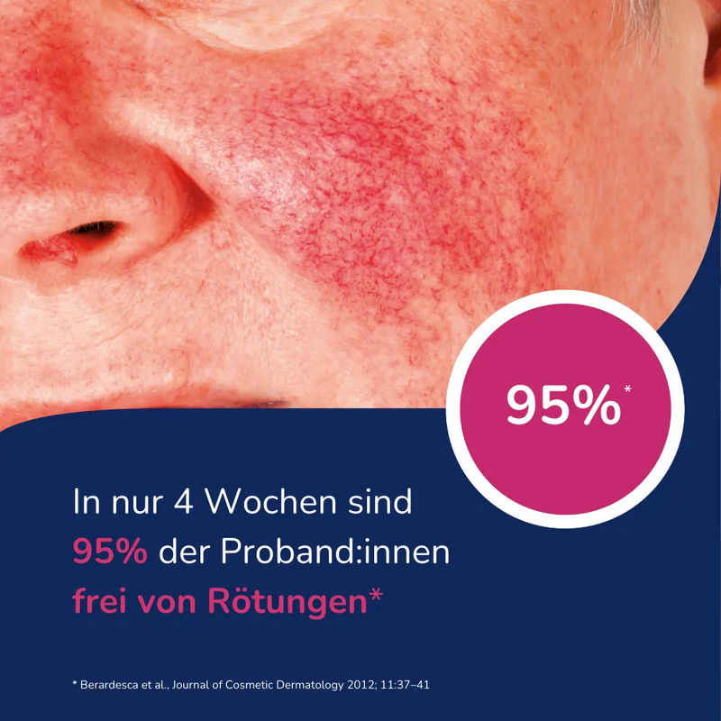 Allergika Anti-Rötung Rosacea Creme MED 30 ml Creme