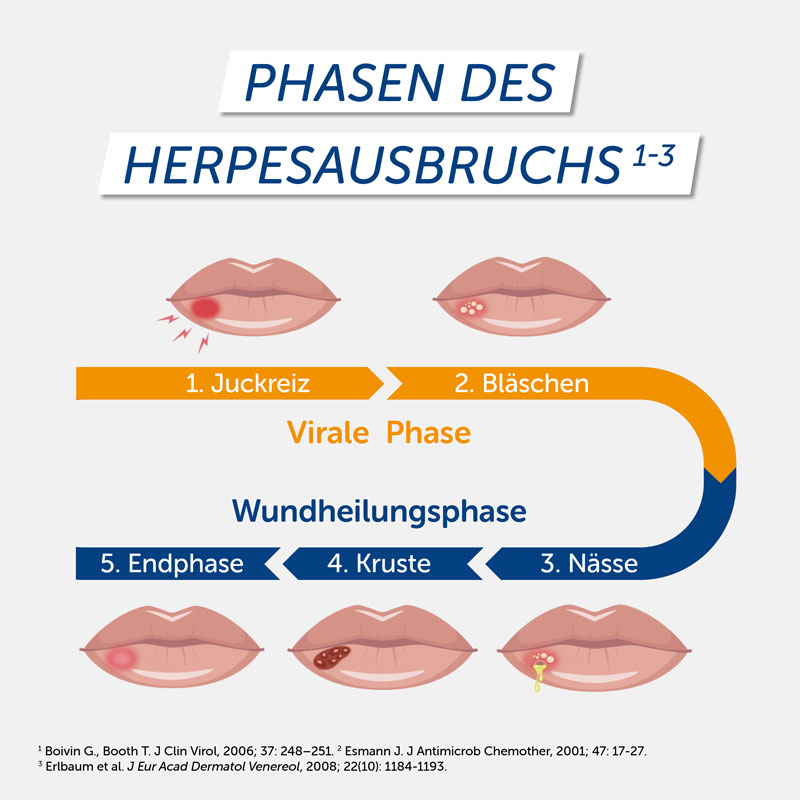 PENCIVIR BEI LIPPENHERPES 2 g Creme