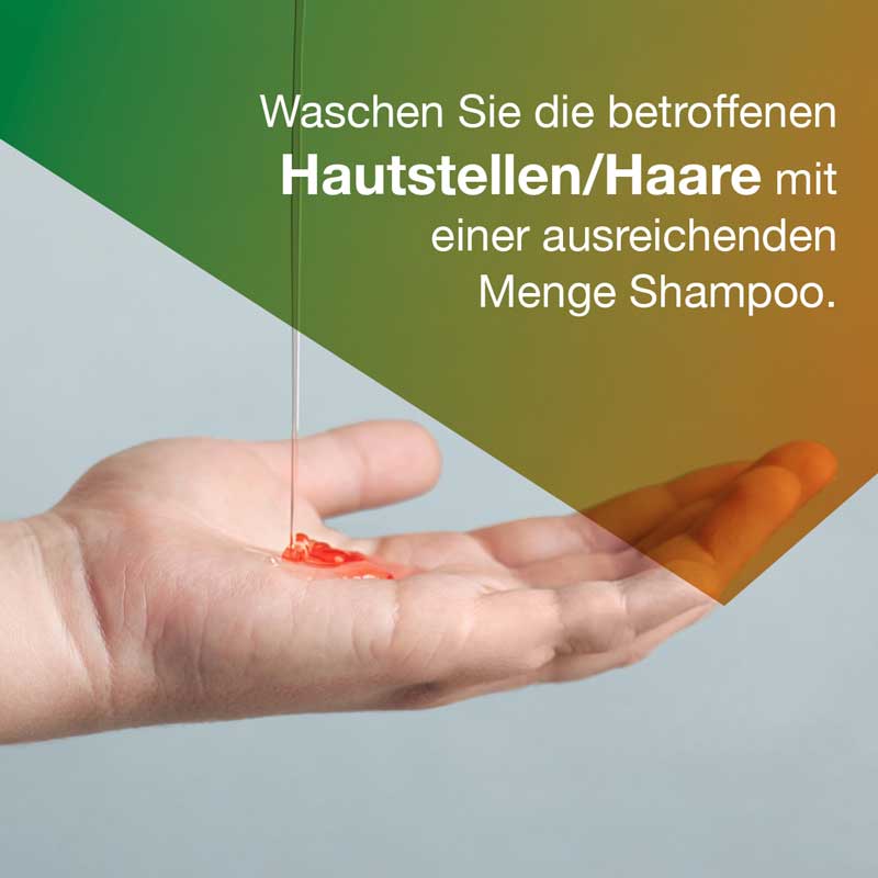 Ketozolin 2% Shampoo 60 ml Shampoo