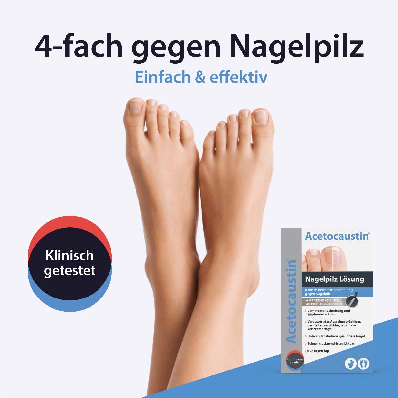 Acetocaustin Nagelpilz Lösung  5 ml Lösung