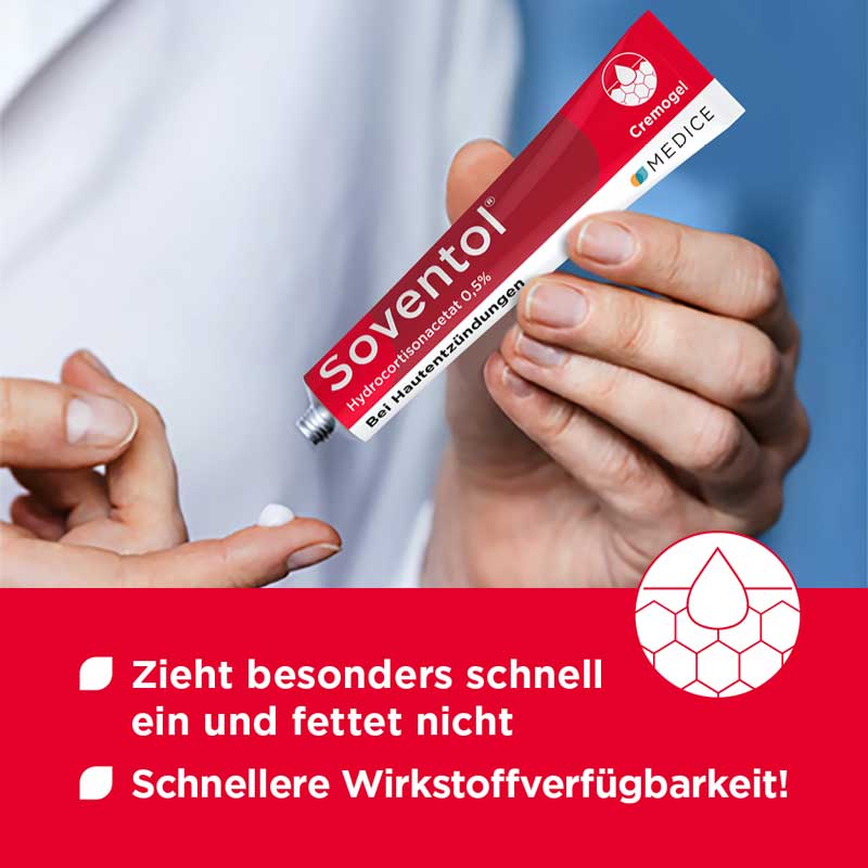 Soventol HydroCortisonACETAT 0,5% bei Hautentzündungen 15 g Creme