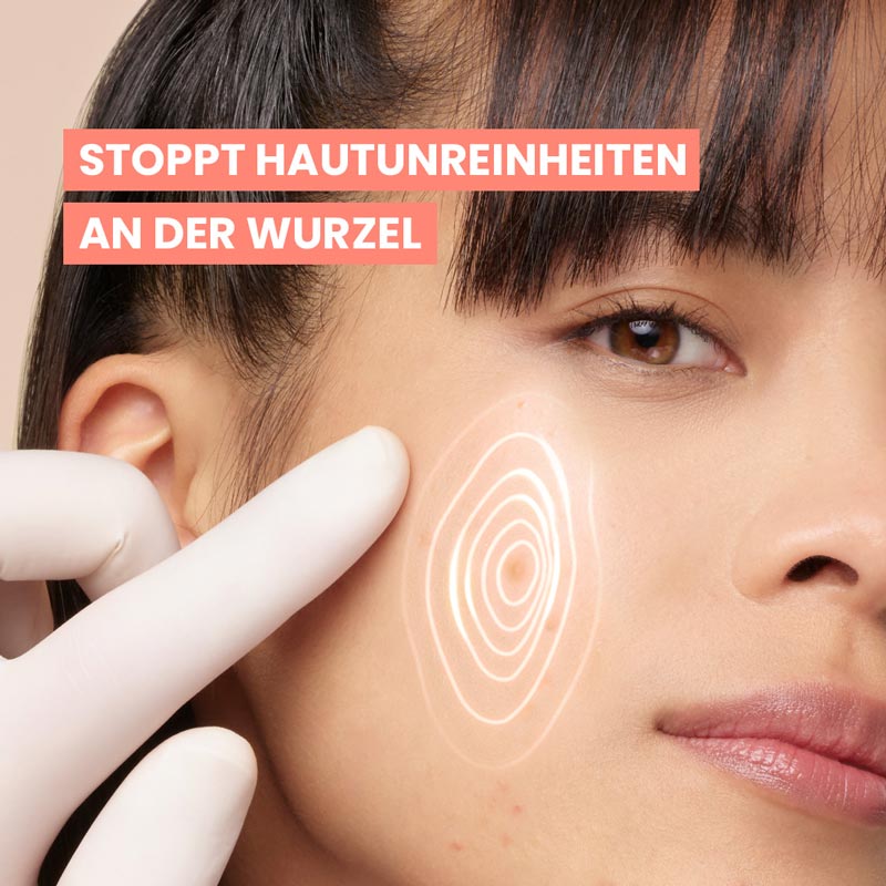 Avène CLEANANCE COMEDOMED+ 30 ml Konzentrat