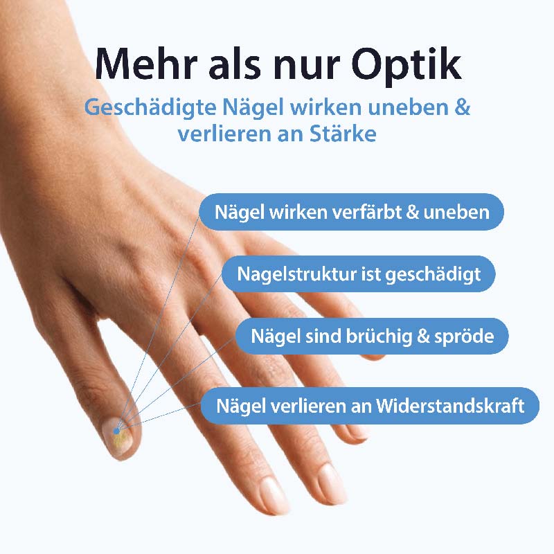 Acetocaustin Nagel Pflege & Reparatur Lösung 9 ml Lösung