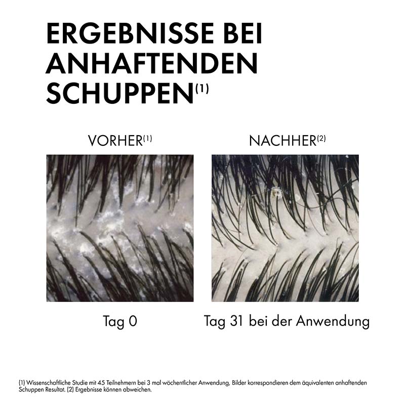 VICHY DERCOS Anti-Schuppen Shampoo trockene Kopfhaut  200 ml Shampoo