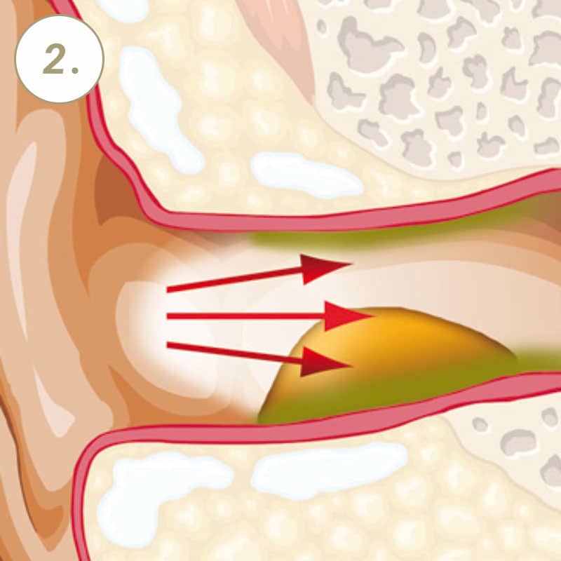 VAXOL OHRENSPRAY 10 ml Spray