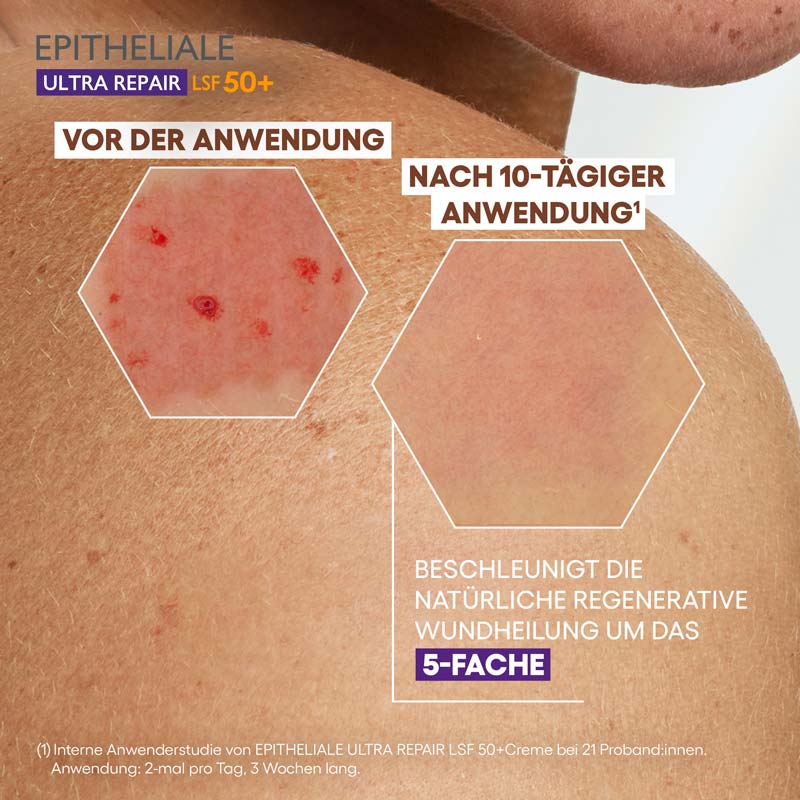 A-DERMA EPITHELIALE ULTRA REPAIR Regenerierende Creme LSF50+ 40 ml Creme