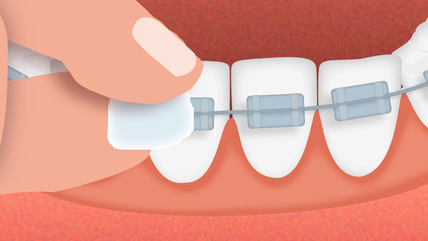 GUM Ortho Wachs 1 St