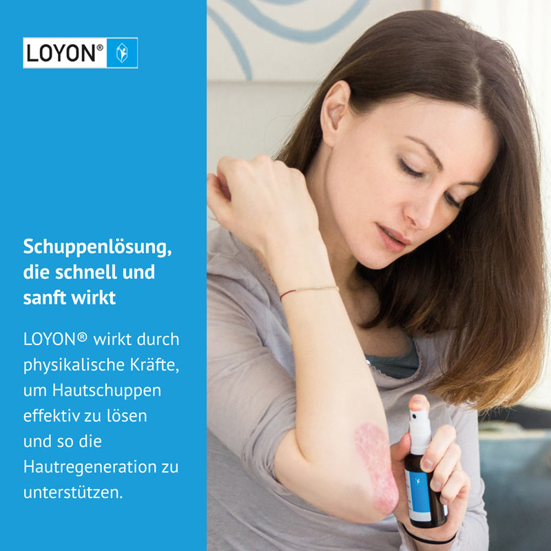LOYON bei Schuppenflechte, Milchschorf & Kopfgneis 15 ml Lösung 15 ml Lösung