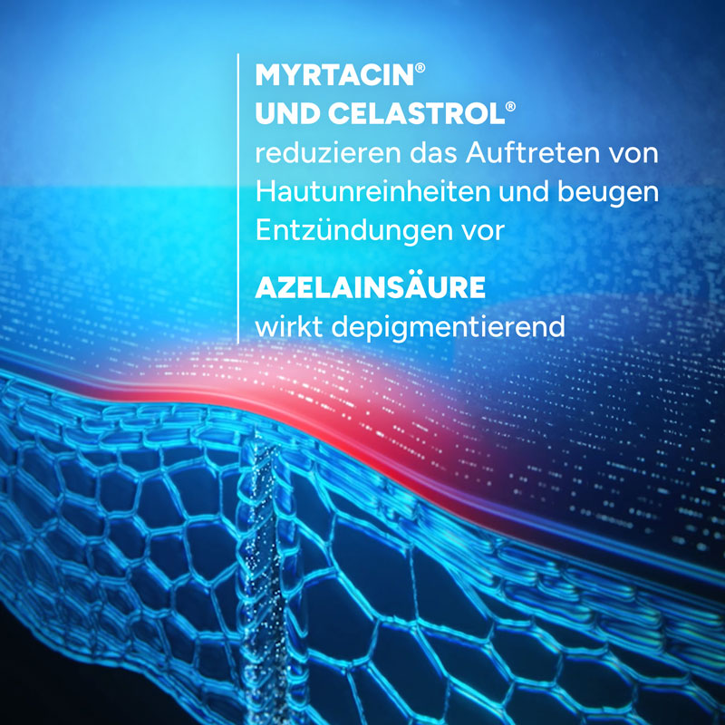 DUCRAY KERACNYL REGULIERENDES SERUM 30 ml Konzentrat